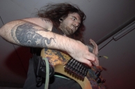 VULVODYNIA